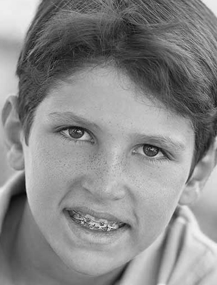 photo: boy with braces